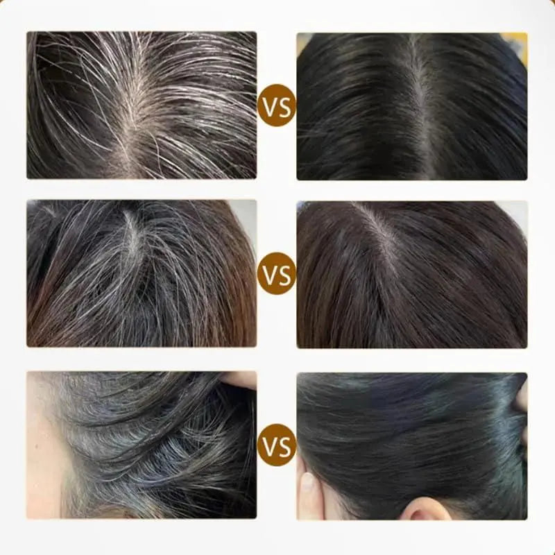 Covering White Hair is Simple and Convenient 20gm Trandingstor.shop