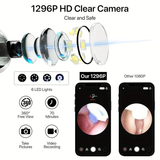 Smart Visual Ear Wax Cleaner - Trandingstor.shop
